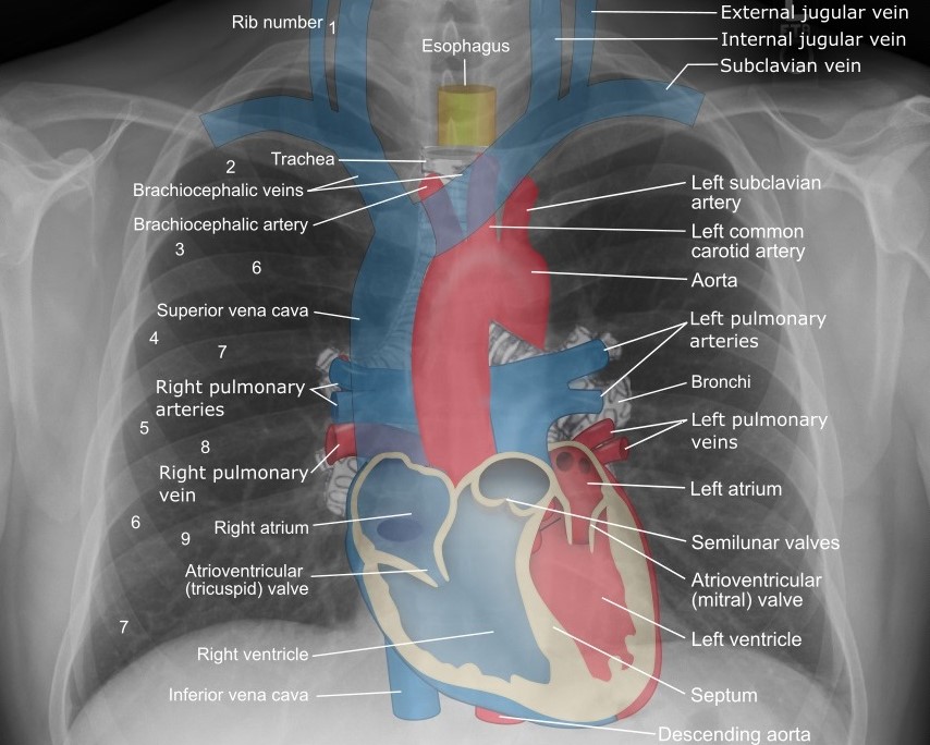 XRAY ANNOTATION