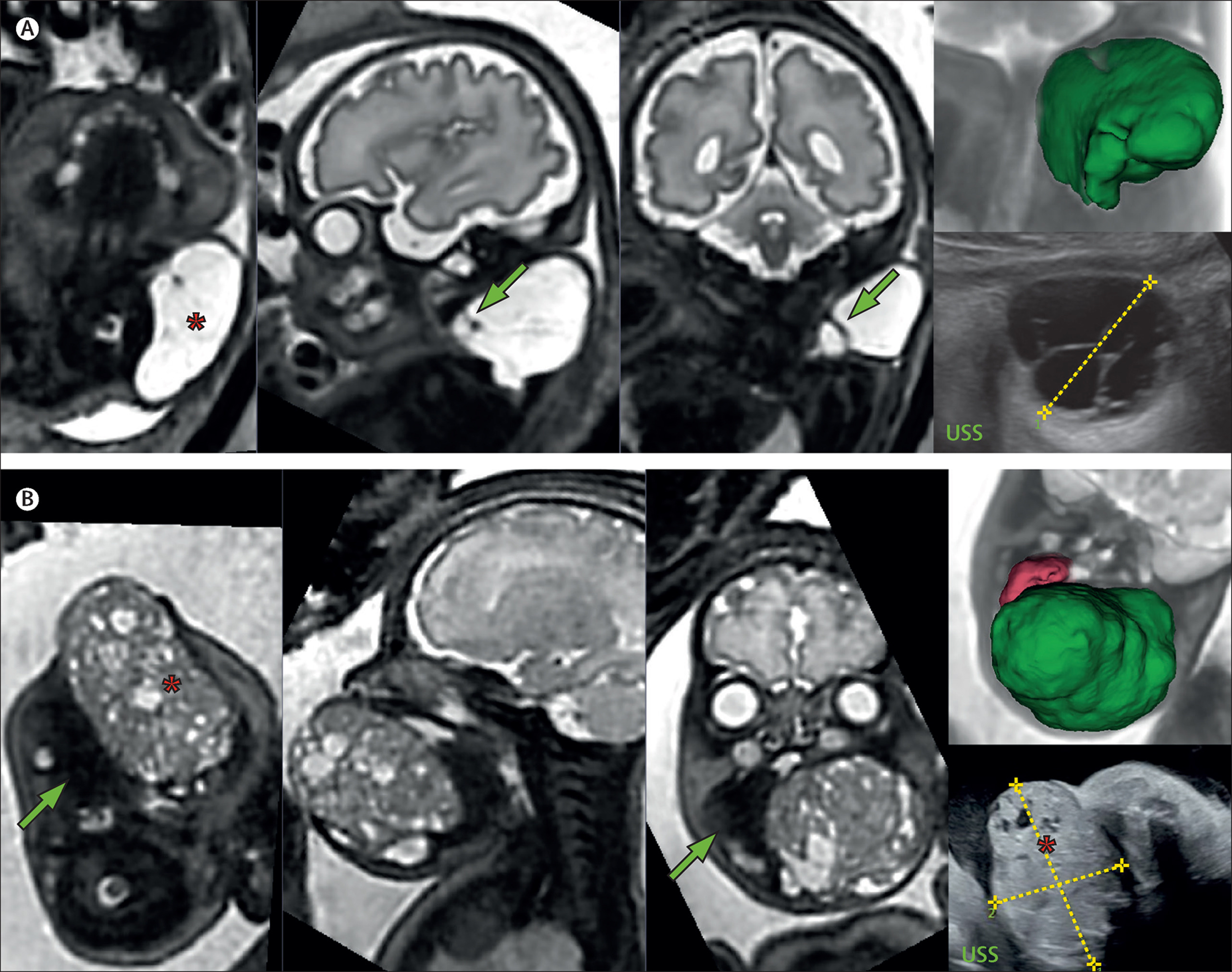 Outsource Medical Annotation for AI